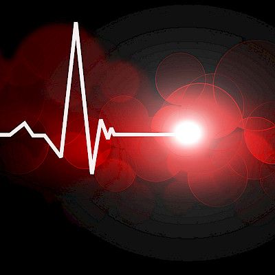 Sydänlihaksen arpi kertoo aiemmasta sydäninfarktista