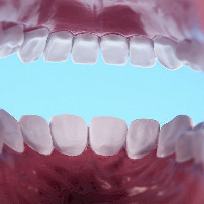 Uutta tietoa nivelreumapotilaiden suun terveydestä