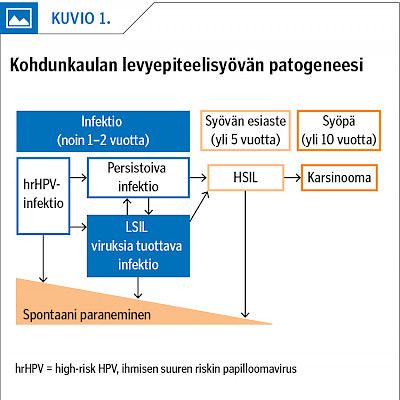 HPV-infektio vai syövän esiaste?Kohdunkaulan, emättimen ja ulkosynnyttimien syöpien esiasteiden tautiluokitus