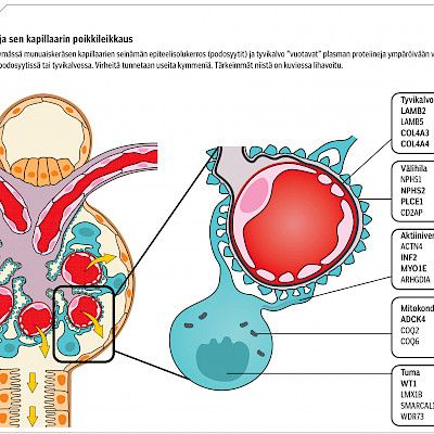 Nephrotic syndrome: when is genetic testing indicated?