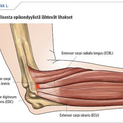 Diagnostic work-up and treatment of chronic elbow pain in adults