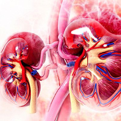 Valvira myönsi munuaissiirtoluvan luovuttajan ystävän hoitoon
