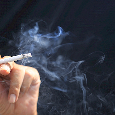 Tupakointi lisää yläraajan hermopinteiden riskiä