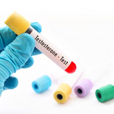 Testosteronihoidon päälinjoista  kansainvälinen yhteisymmärrys