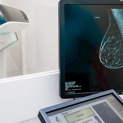 Tekoäly seuloi rintasyövän radiologia paremmin