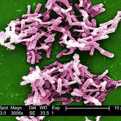 Clostridium difficile at the Department of Paediatrics at Tampere University Hospital