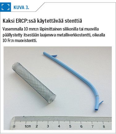 Kaksi ERCP:ssä käytettävää stenttiä