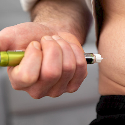 Yhä useampi alle 20-vuotias sairastuu tyypin 2 diabetekseen