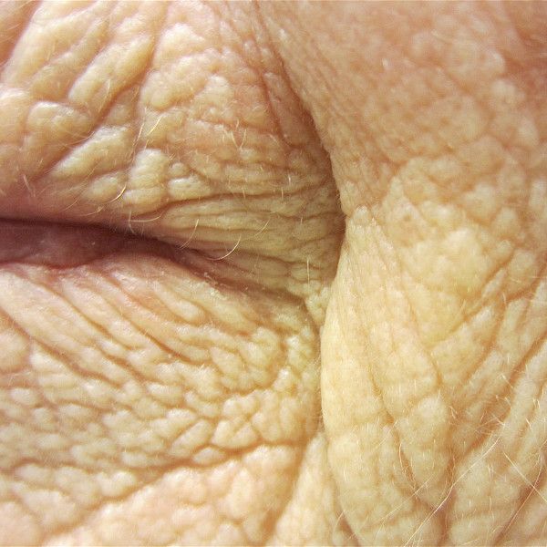 Skin problems in the elderly
