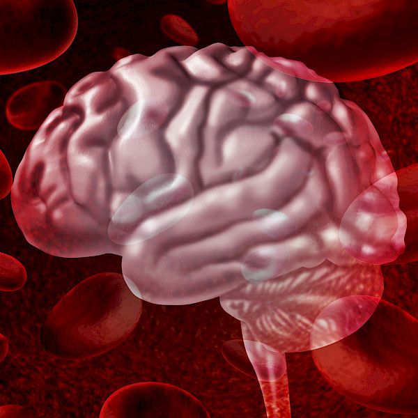 Muistisairauksien ehkäisyohjelmasta saatava hyöty yhteydessä aivojen rakenteeseen