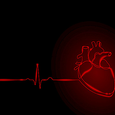 Sydäninfarktipotilaille hyötyä tavallista korkeammasta verenpaineesta