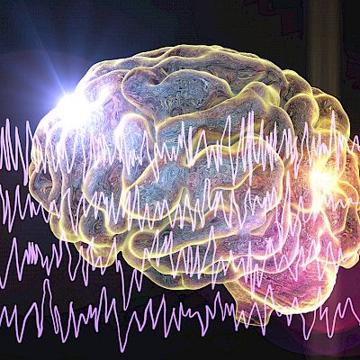 EPM1-epilepsia yleisempi Suomessa kuin missään muualla