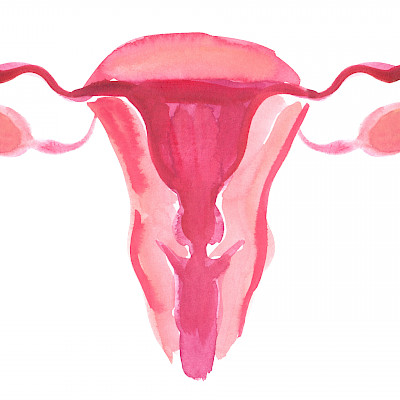 Endometrioosista laaja rekisteritutkimus
