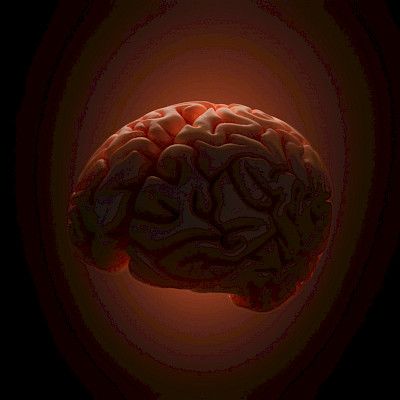 Suomalaisia tietokantoja mukana tutkimuksessa aivoaneurysmien perinnöllisyydestä