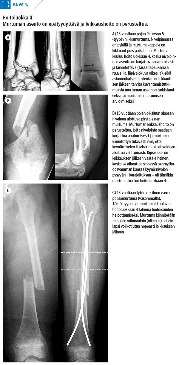 Hoitoluokka 4
Murtuman asento on epätyydyttävä ja leikkaushoito on perusteltua.