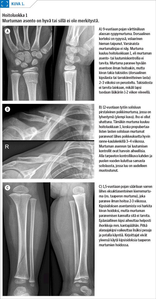 Hoitoluokka 1
Murtuman asento on hyvä tai sillä ei ole merkitystä.