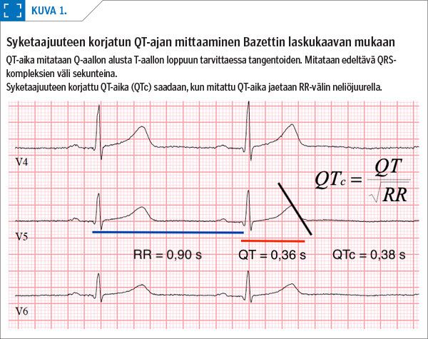 Syketaajuuteen korjatun QT-ajan mittaaminen Bazettin laskukaavan mukaan