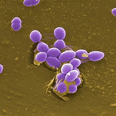 Enterococcus faecalis sopeutui sairaalaoloihin jo 1800-luvulla
