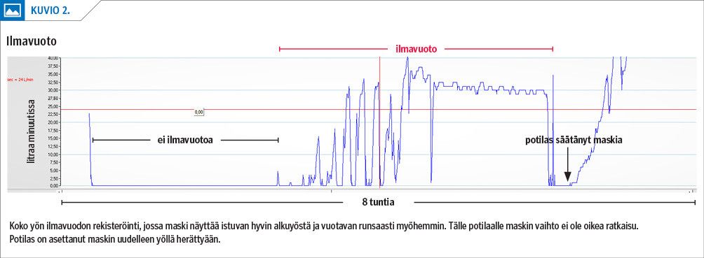 Ilmavuoto