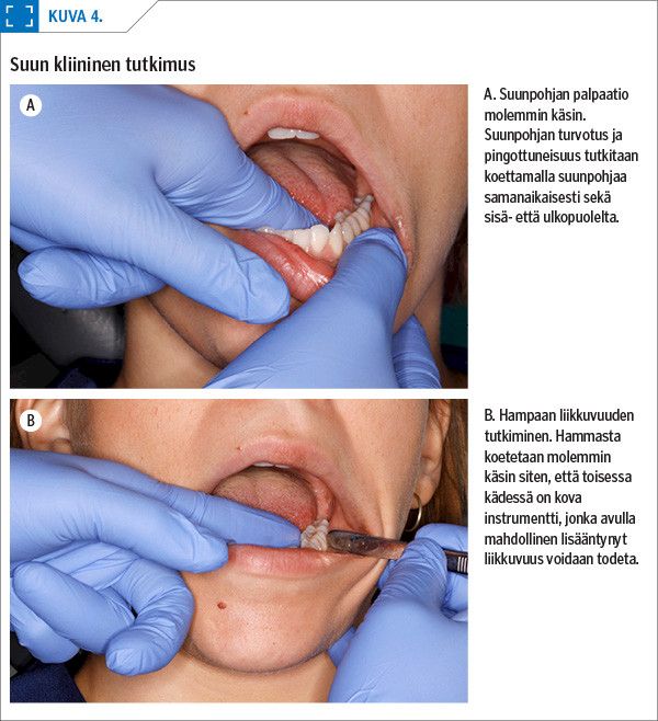 Suun kliininen tutkimus<p/>