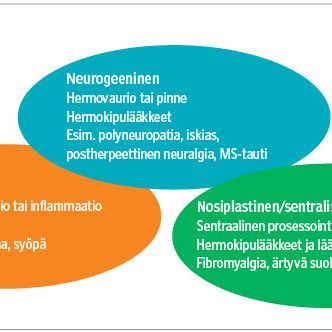 Kroonistuneen kivun arviointi rationaaliseksi