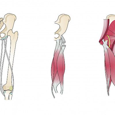 Hamstring injuries and disorders