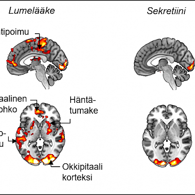 Tutkijat löysivät uuden kylläisyyttä säätelevän mekanismin