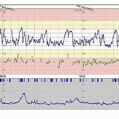 Sikiön fysiologiaan perustuva kardiotokografian tulkinta