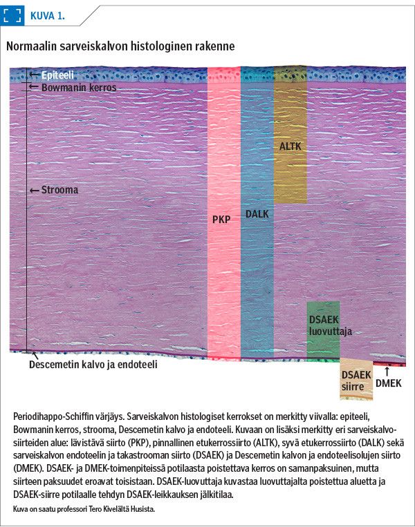 Normaalin sarveiskalvon histologinen rakenne <p/>