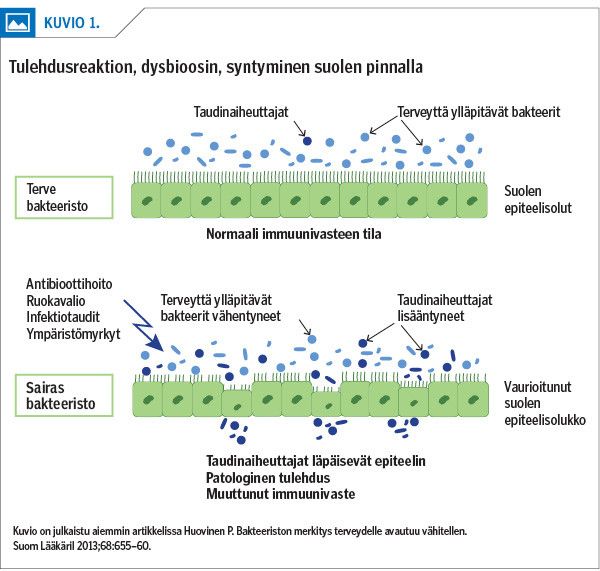 Tulehdusreaktion, dysbioosin, syntyminen suolen pinnalla