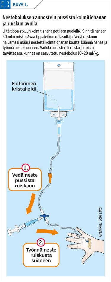 Nesteboluksen annostelu pussista kolmitiehanan ja ruiskun avulla