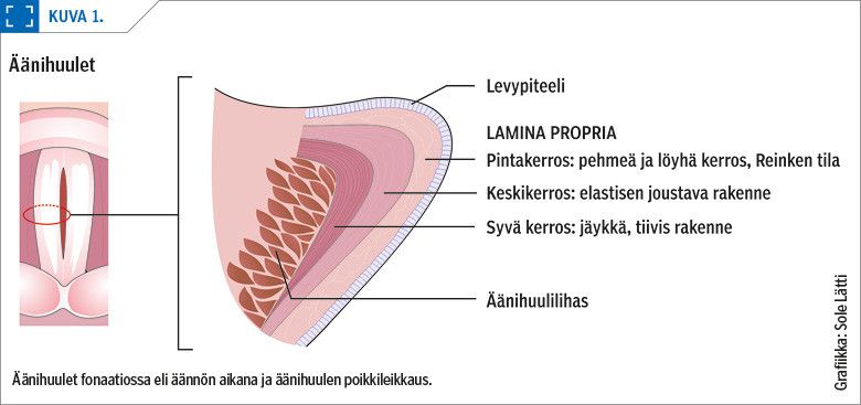 Äänihuulet