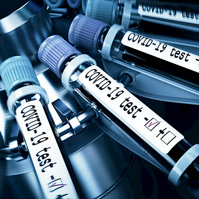 Koronainfektion laboratoriodiagnostiikka:Miten laboratorio valitsee menetelmät?