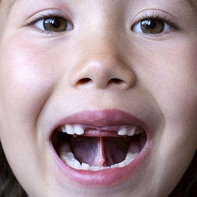 Koronaepidemia kasvatti suun terveydenhuollon hoitovelkaa