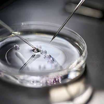 Hedelmöityshoitoihin tulee Palkolta uusia suosituksia