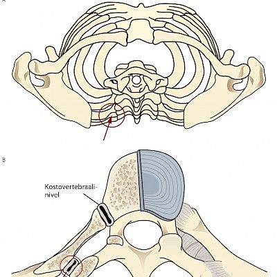 Injuries of the costovertebral joints may be overlooked when determining the cause of shoulder pain