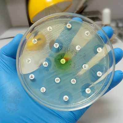 Resistenssitilanne huononee – tuovatko uudet mikrobilääkkeet avun?