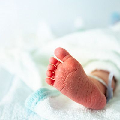 Hypoglycaemia of the newborn