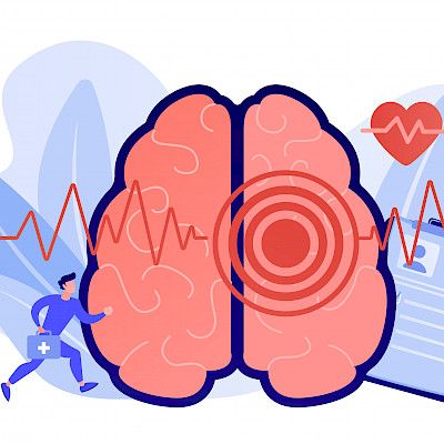 Liuotushoito ei aina paranna aivoinfarktin ennustetta