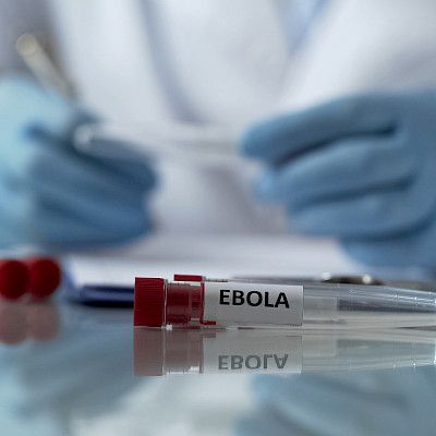 Ugandassa uusi ebolaepidemia