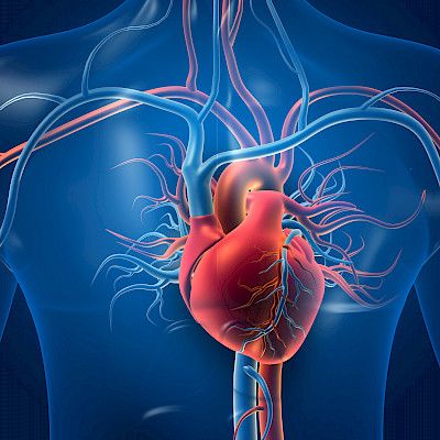 Veren virtausmuutoksista voi saada tietoa aortan repeytymisriskistä