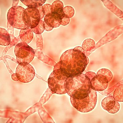 The first isolate of Candida auris was obtained following routine screening