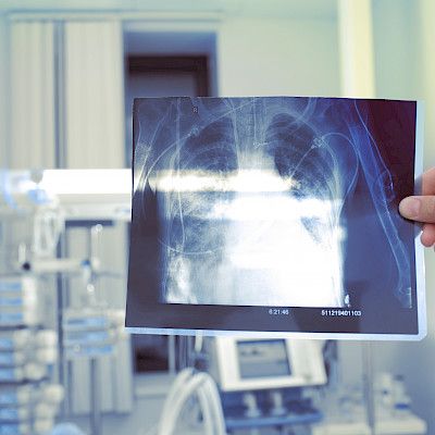 When to suspect occupational respiratory disease?