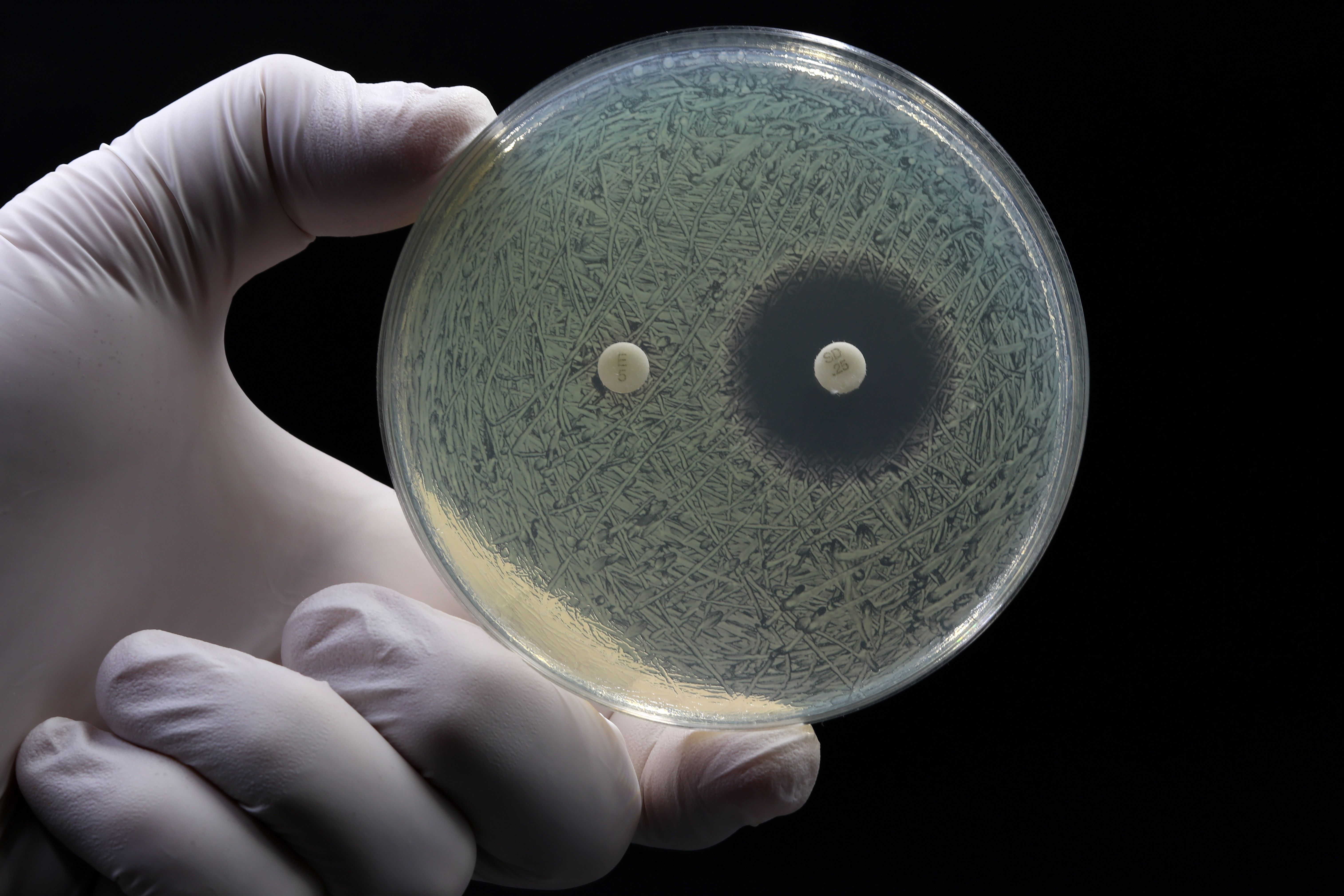 antibioot-eille-resistentit-cpe-bakteerit-lis-ntyneet-suomessa