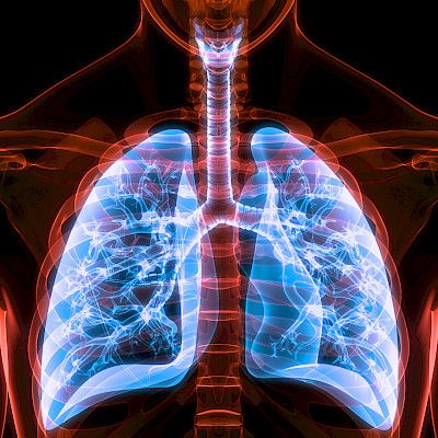 Keuhkosairausohjelmat ovat esimerkki systemaattisesta kansanterveystyöstä