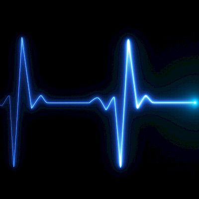 EKG ennustaa hyvin kuolleisuutta sepelvaltimotautikohtauksissa