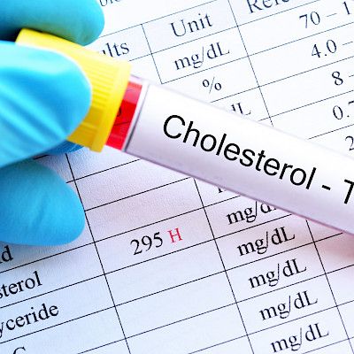 Nuorten kolesterolipassi avuksi valtimotaudin ennaltaehkäisyyn