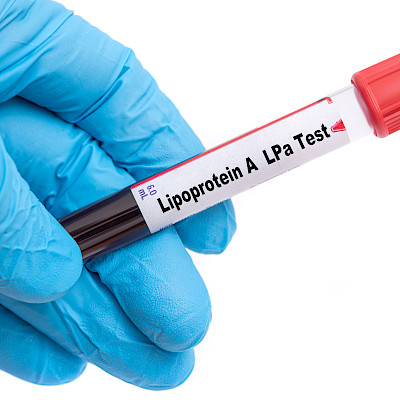 Lipoproteiini (a) – valtimotaudin salakavala riskitekijä