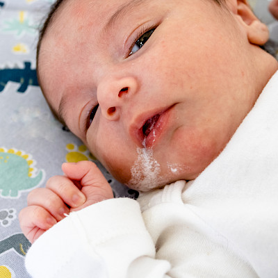 Protonipumpun estäjät lisäävät vakavien infektioiden riskiä pikkulapsilla