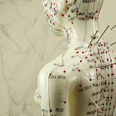 Akupunktuuri – huuhaata vai pätevää fysikaalista hoitoa?
